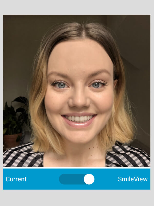 What Would I Look Like With Straight Teeth